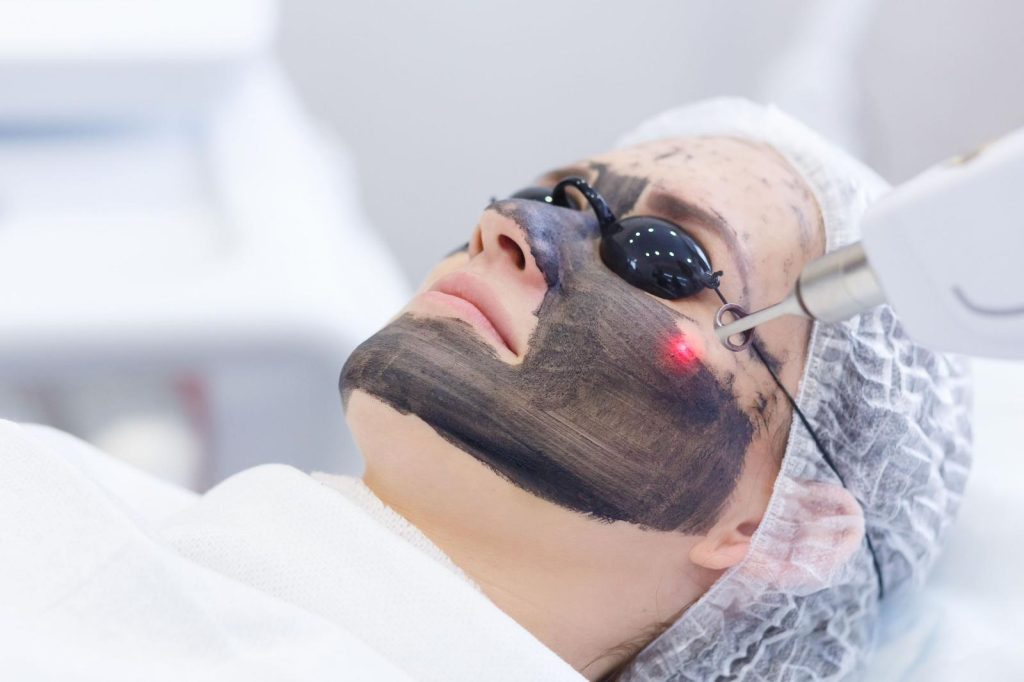 Corbon Peel
Peeling au carbone
Carbon laser peel
Peeling laser carbone
Nettoyage peau profond
Soin éclat visage
Peau lumineuse
Réduction des pores
Purification peau
Soin anti-imperfections
Régulation sébum
Peeling doux
Traitement peau grasse
Réduction points noirs
Laser peel
Teint uniforme