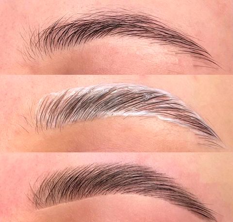 Brow lift
Rehaussement sourcils
Lifting sourcils
Brow lift
Lifting frontal
Sourcils liftés
Regard lifté
Lifting regard